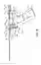 Fig. 16 - Soft tissue coring biopsy devices and methods
