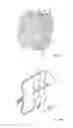Fig. 12 - EXPANDABLE OCCLUSION DEVICES AND METHODS OF USE