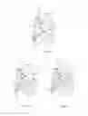 Fig. 15 - EXPANDABLE OCCLUSION DEVICES AND METHODS OF USE