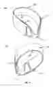 Fig. 10 - Methods and devices to reduce the likelihood of injury from concussive or blast forces