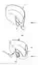 Fig. 15 - Methods and devices to reduce the likelihood of injury from concussive or blast forces