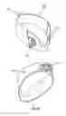 Fig. 16 - Methods and devices to reduce the likelihood of injury from concussive or blast forces