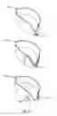 Fig. 17 - Methods and devices to reduce the likelihood of injury from concussive or blast forces