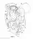 Fig. 03 - Lockable Pedicle Fastener