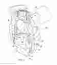 Fig. 04 - Lockable Pedicle Fastener