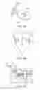 Fig. 06 - SACRAL TETHER ANCHOR AND METHODS OF USE