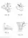 Fig. 09 - SACRAL TETHER ANCHOR AND METHODS OF USE