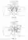 Fig. 16 - SACRAL TETHER ANCHOR AND METHODS OF USE