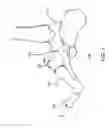 Fig. 02 - Devices and methods for bone fixation using axial implants