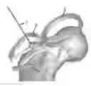 Fig. 01 - METHODS AND DEVICES FOR VALIDATING THE POSITION OF PATIENT-SPECIFIC DEVICES