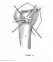 Fig. 04 - METHODS AND DEVICES FOR VALIDATING THE POSITION OF PATIENT-SPECIFIC DEVICES