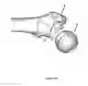 Fig. 09 - METHODS AND DEVICES FOR VALIDATING THE POSITION OF PATIENT-SPECIFIC DEVICES