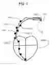 Fig. 03 - Cell electric stimulator with separate electrodes for electrical field shaping and for stimulation