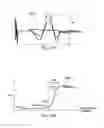 Fig. 15 - Pudendal and sacral nerve stimulation sweep algorithm and method