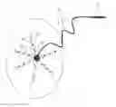 Fig. 01 - Multizone epicardial pacing lead