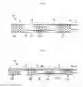 Fig. 04 - STENT FOR ELECTROTHERMAL TREATMENT