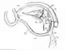 Fig. 01 - Tissue fastening systems and methods utilizing magnetic guidance