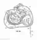 Fig. 16 - Tissue fastening systems and methods utilizing magnetic guidance