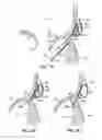 Fig. 22 - Tissue fastening systems and methods utilizing magnetic guidance