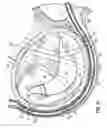 Fig. 28 - Tissue fastening systems and methods utilizing magnetic guidance