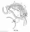 Fig. 33 - Tissue fastening systems and methods utilizing magnetic guidance