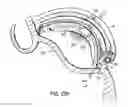 Fig. 34 - Tissue fastening systems and methods utilizing magnetic guidance