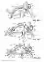 Fig. 41 - Tissue fastening systems and methods utilizing magnetic guidance