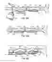 Fig. 45 - Tissue fastening systems and methods utilizing magnetic guidance
