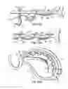 Fig. 47 - Tissue fastening systems and methods utilizing magnetic guidance