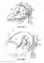 Fig. 68 - Tissue fastening systems and methods utilizing magnetic guidance