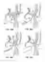 Fig. 69 - Tissue fastening systems and methods utilizing magnetic guidance