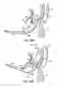 Fig. 70 - Tissue fastening systems and methods utilizing magnetic guidance
