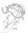 Fig. 76 - Tissue fastening systems and methods utilizing magnetic guidance