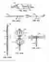 Fig. 77 - Tissue fastening systems and methods utilizing magnetic guidance