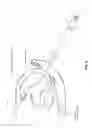 Fig. 06 - METHOD AND APPARATUS FOR REPAIRING A MITRAL VALVE