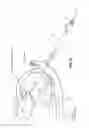 Fig. 08 - METHOD AND APPARATUS FOR REPAIRING A MITRAL VALVE