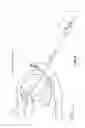 Fig. 09 - METHOD AND APPARATUS FOR REPAIRING A MITRAL VALVE