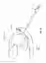 Fig. 32 - METHOD AND APPARATUS FOR REPAIRING A MITRAL VALVE