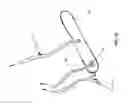 Fig. 44 - METHOD AND APPARATUS FOR REPAIRING A MITRAL VALVE