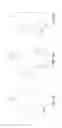 Fig. 05 - DEFORMABLE ACCOMMODATIVE INTRAOCULAR LENS