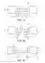 Fig. 02 - Cortical loop fixation system for ligament and bone reconstruction