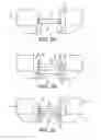 Fig. 03 - Cortical loop fixation system for ligament and bone reconstruction