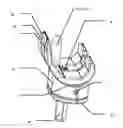 Fig. 01 - SPACER IMPLANT FOR THE TEMPORARY REPLACEMENT OF A KNEE PROSTHESIS
