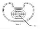 Fig. 07 - SPACER IMPLANT FOR THE TEMPORARY REPLACEMENT OF A KNEE PROSTHESIS