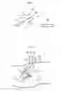 Fig. 06 - Hip joint method
