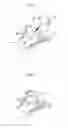 Fig. 08 - Hip joint method