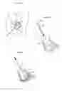 Fig. 19 - Hip joint method