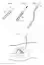 Fig. 20 - Hip joint method