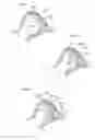 Fig. 25 - Hip joint method