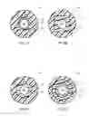 Fig. 04 - Ureteral stents with waveform interlayers and interstitching